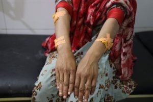 woman's outstretched arms covered in bandages