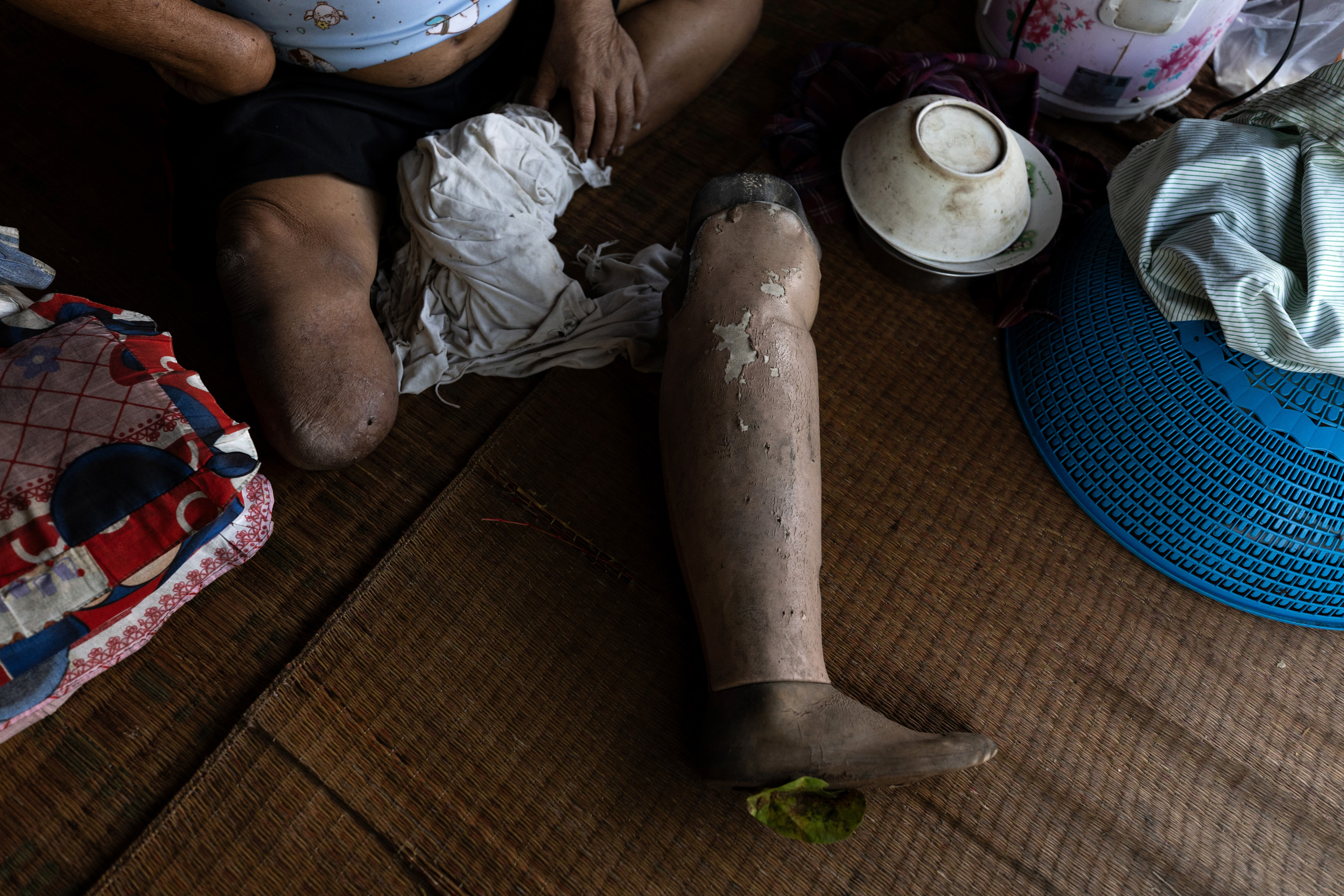 A disable man sitting on the floor, with his amputated leg in front of him.