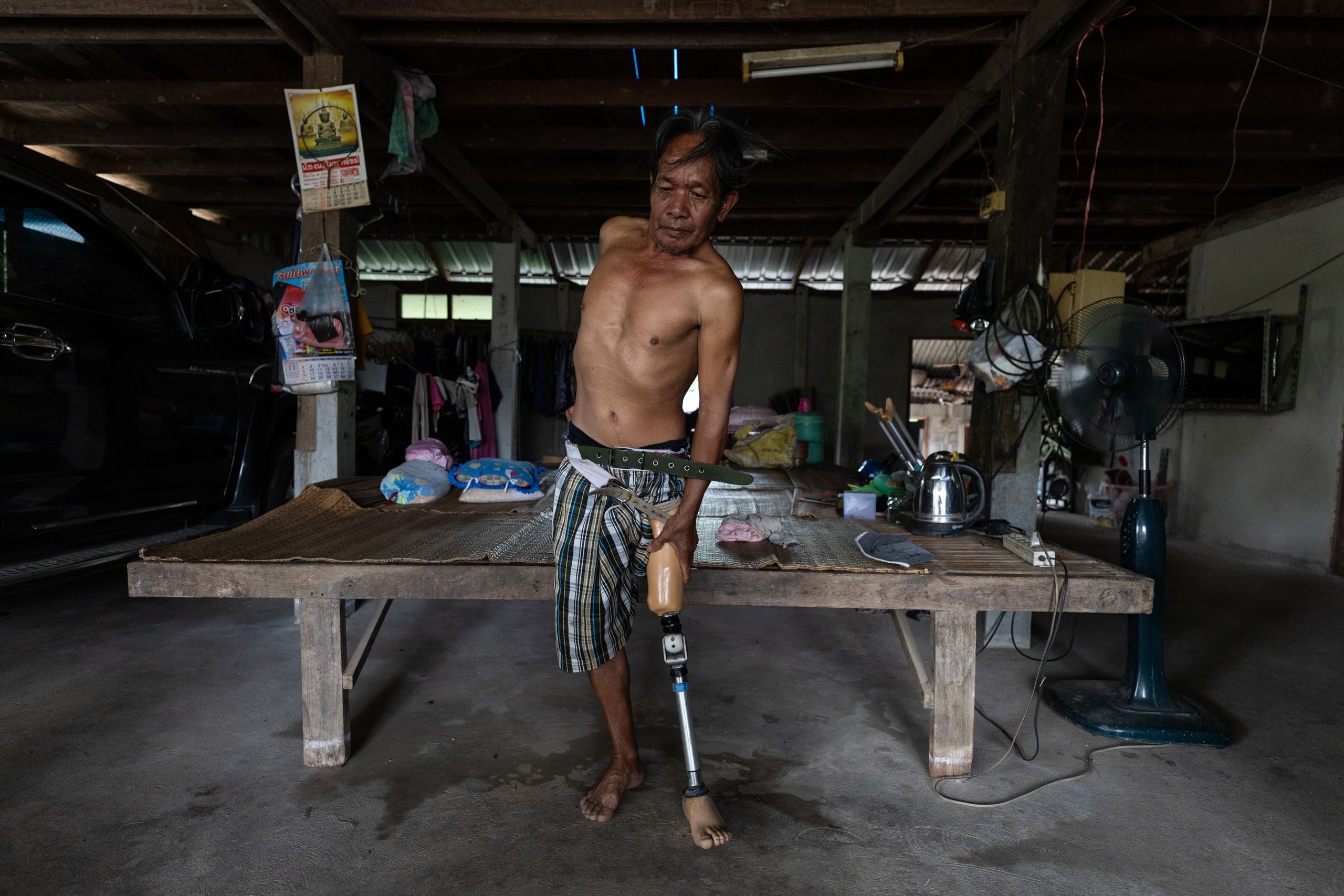 A shirtless man with an upper-limb amputation stands in a rustic room